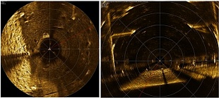TPA "Angara TM-150" with sonar